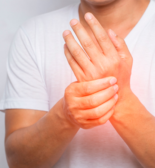 Los principales síntomas de la artritis reumatoide son dolor, inflamación y rigidez.